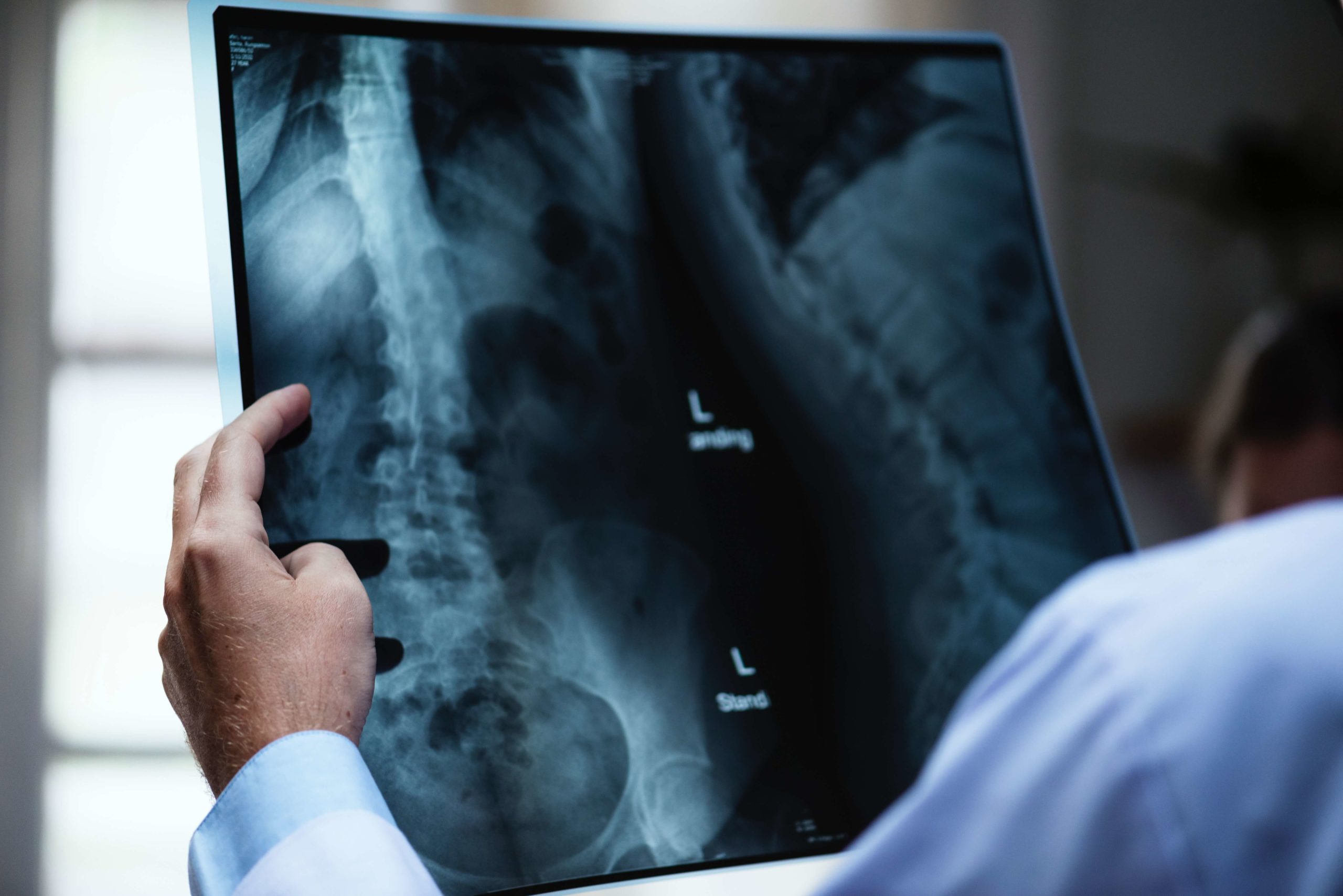Listen Up: Your Spine is Degenerating